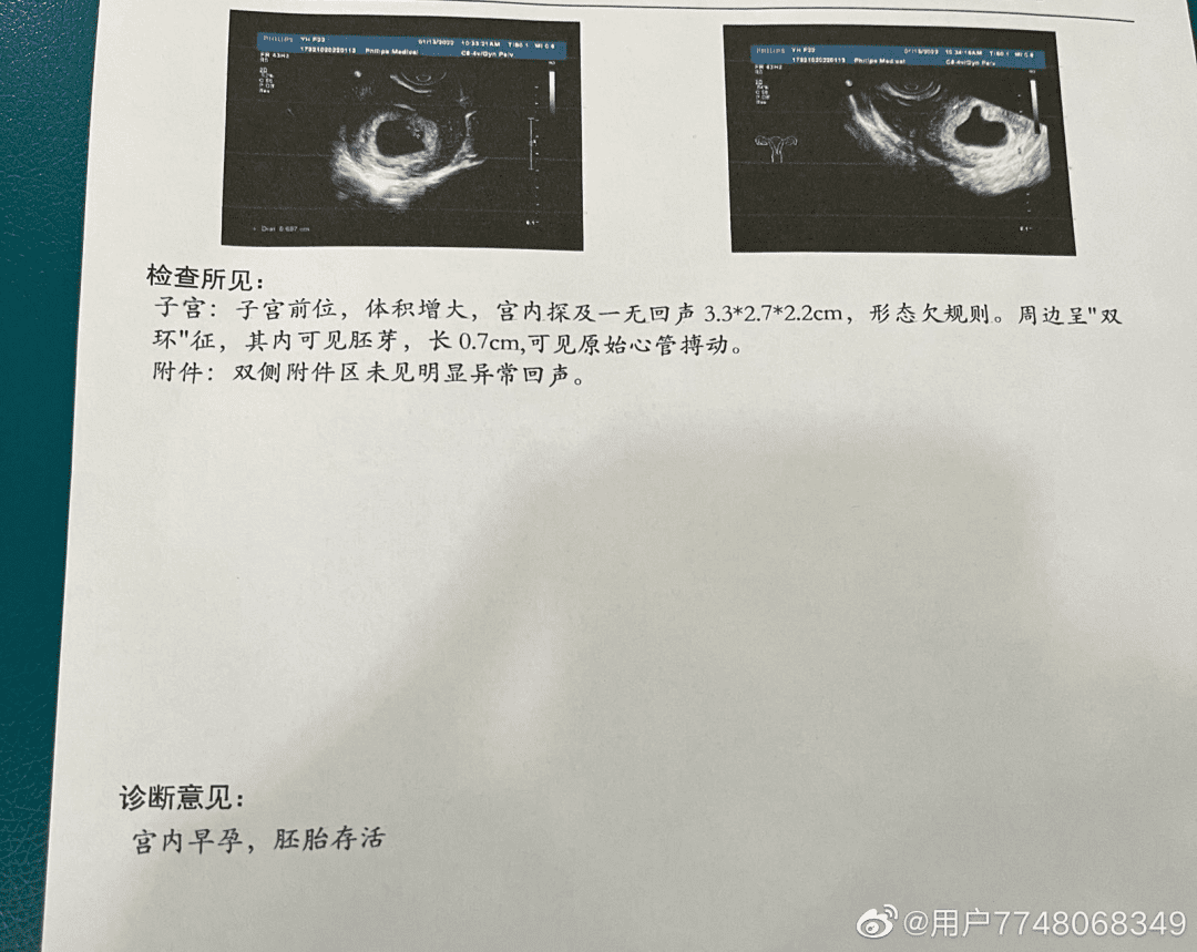 安徽师范大学男生被割是什么瓜？插图3