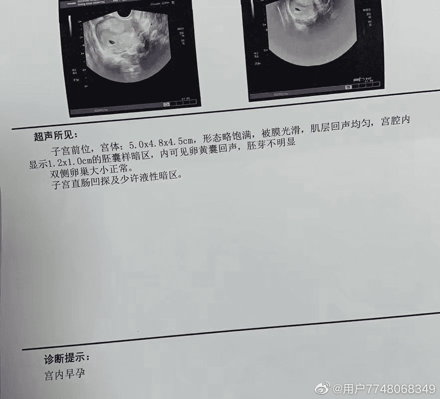 安徽师范大学男生被割是什么瓜？插图5